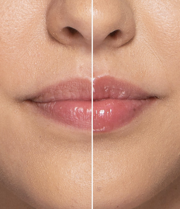 τα καλυτερα lip plumper