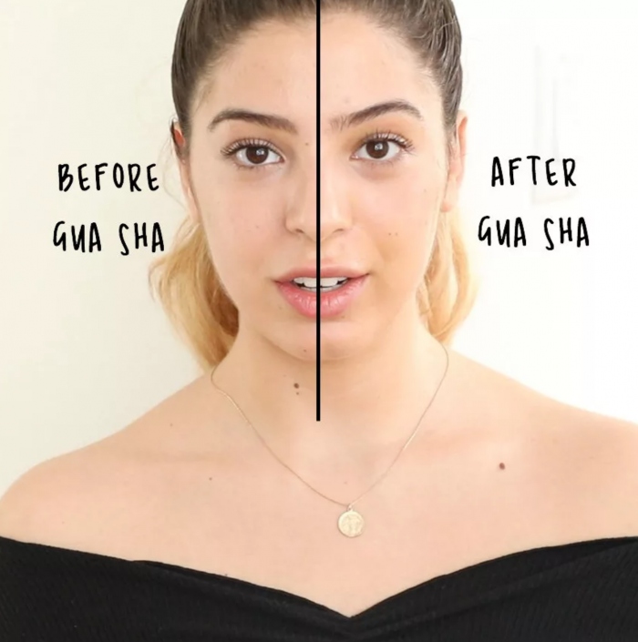 gua sha before and after