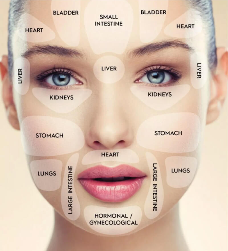 acne face mapping