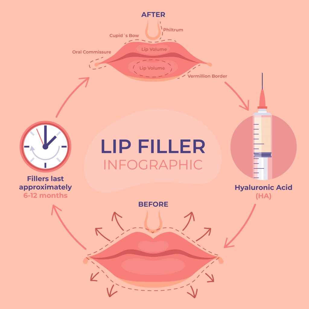 how do lip fillers work