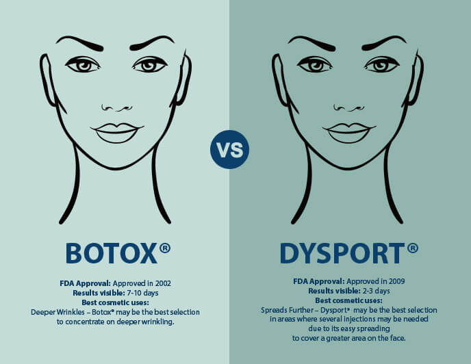 Botox vs Dysport 