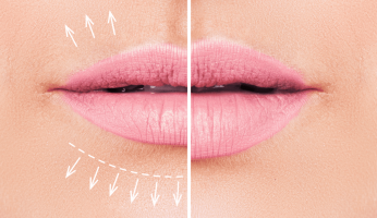 The 5 Best Lip Plumpers of 2021!